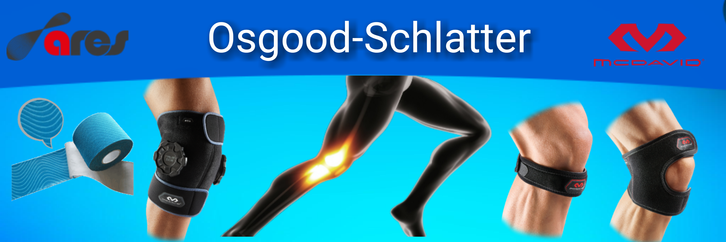 Amitől a térd fájhat 1. – Schlatter-Osgood szindróma